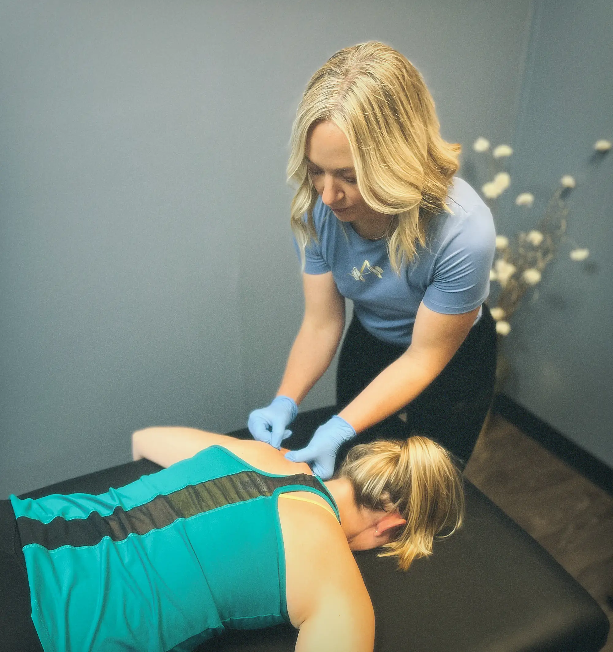 Physical therapist performing dry needling on a patient's upper back